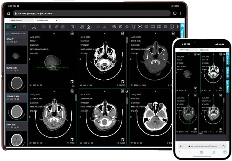 DICOM Viewer Interface